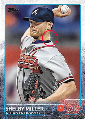 2015-TU-Sparkle-US190-Shelby-Miller